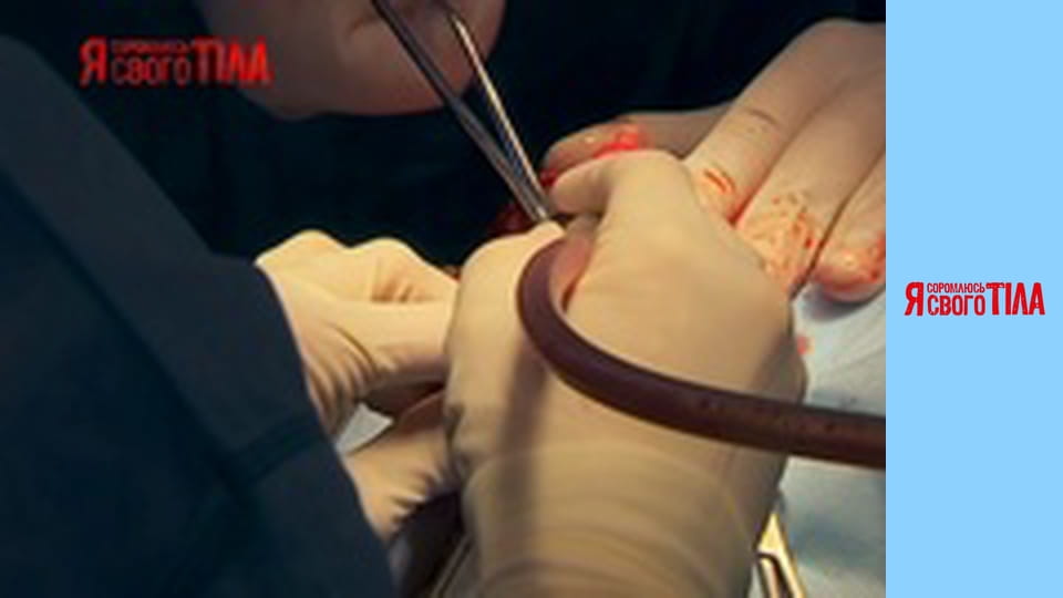 I'm Ashamed of My Body - Season 6 Episode 16 Part 5