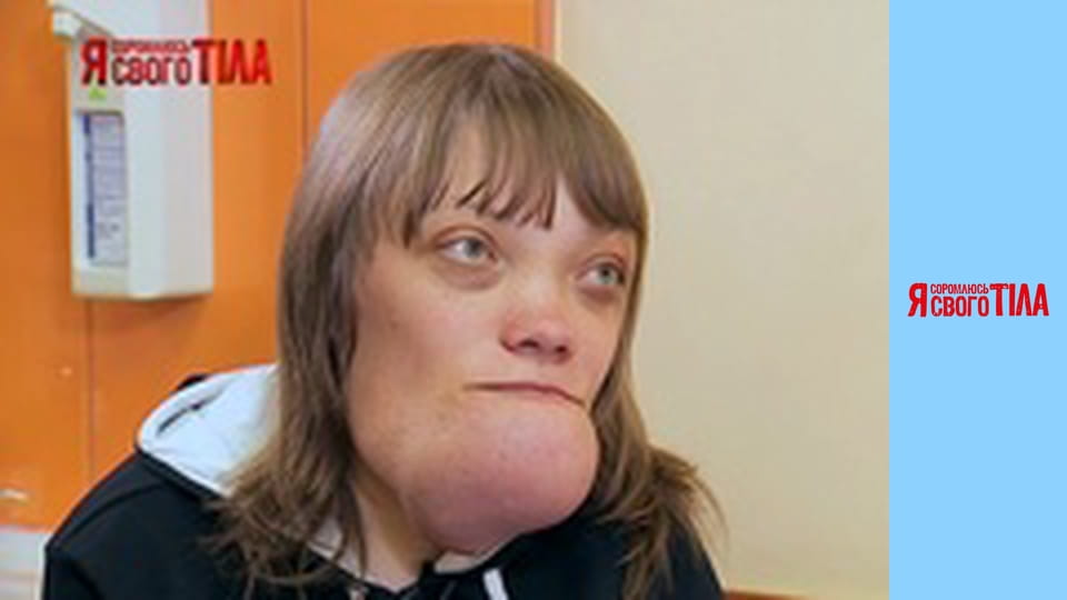 I'm Ashamed of My Body - Season 3 Episode 17 Part 4