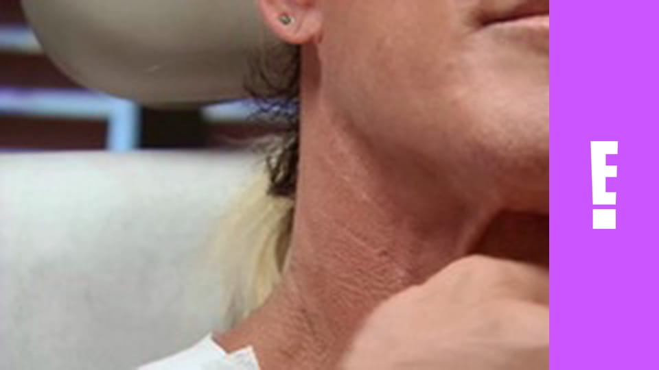 Botched S2E3 - The Bacon Bra