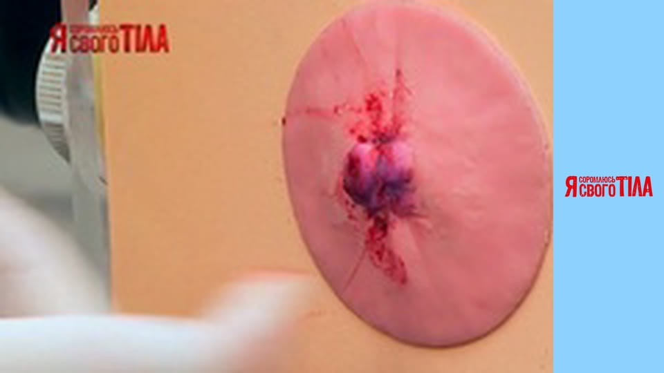 Я соромлюсь свого тіла - Сезон 3 Випуск 11 Частина 2