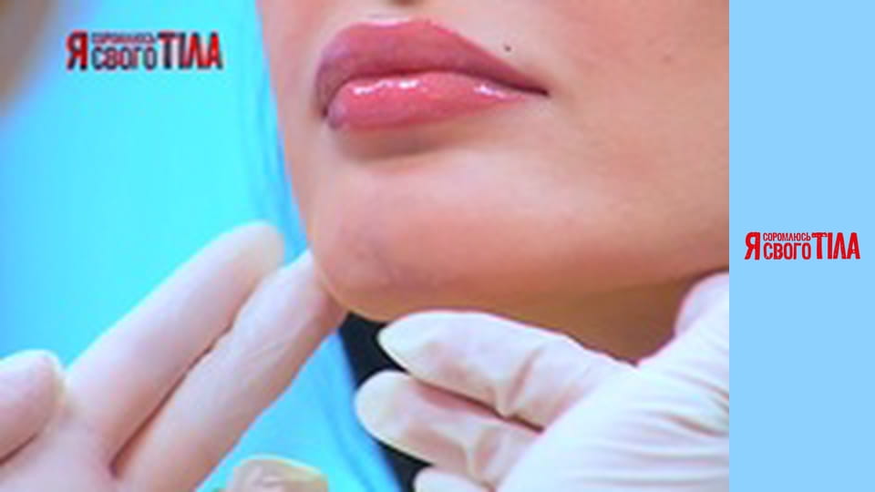 I'm Ashamed of My Body - Season 3 Episode 17 Part 5