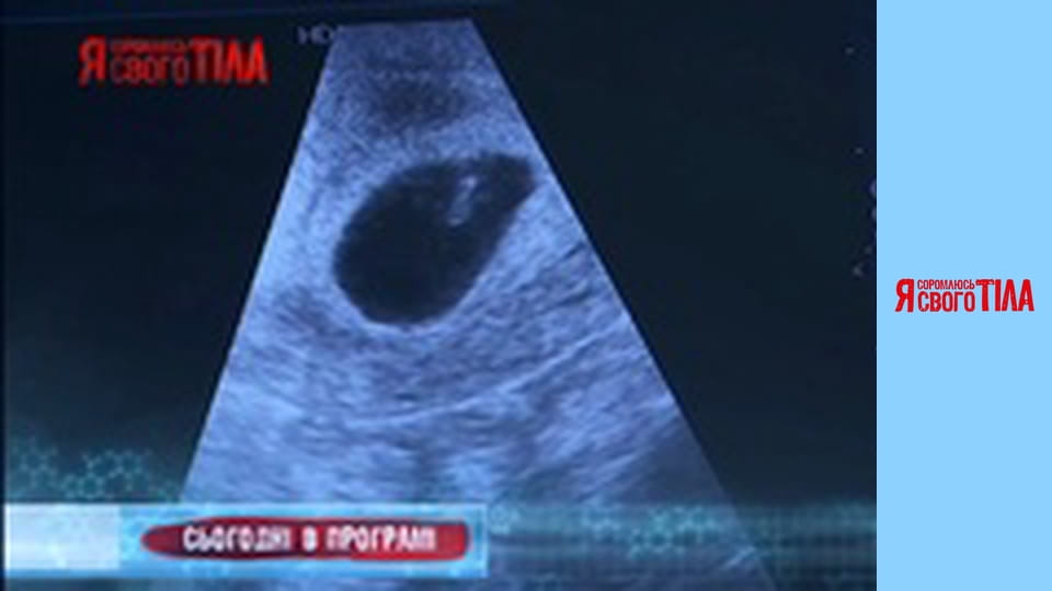 I'm Ashamed of My Body - Season 5 Episode 7 Part 1