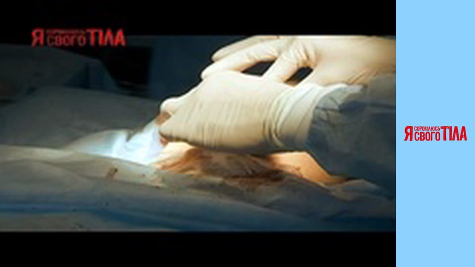 I'm Ashamed of My Body - Season 1 Episode 7 Part 2