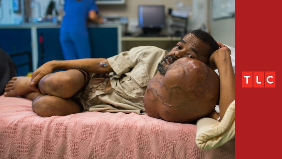 Podivná těla S4E6 - Mám čtyři nohy