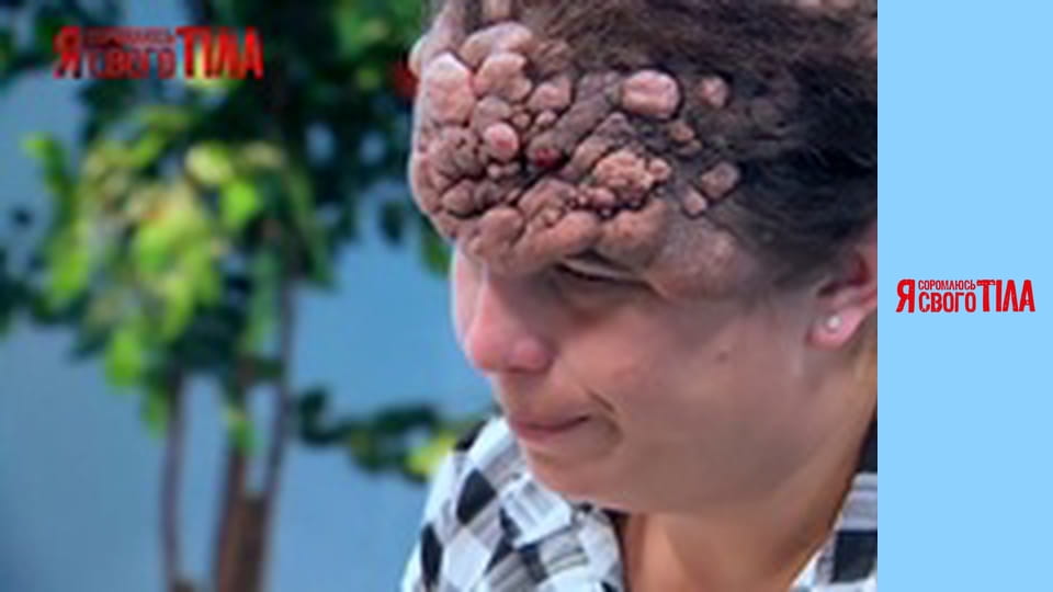 I'm Ashamed of My Body - Season 2 Episode 13 Part 1