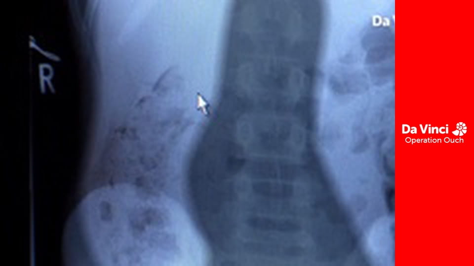 Operacja Auć! - Od choroby lokomocyjnej po dobrze przespane noce