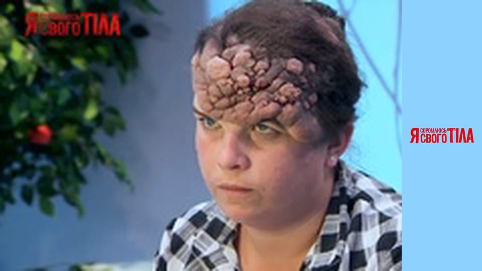 I'm Ashamed of My Body - Season 2 Episode 14 Part 1