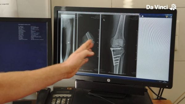 8. Hledání nových léků na osteoartrózu