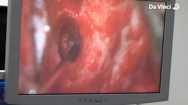 Operation Ouch (2012) - 3 sezóna 3. kašlete na to!