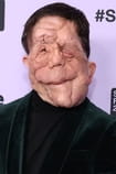 Филми с актьора Adam Pearson - SWEET.TV Филми с актьора Adam Pearson
