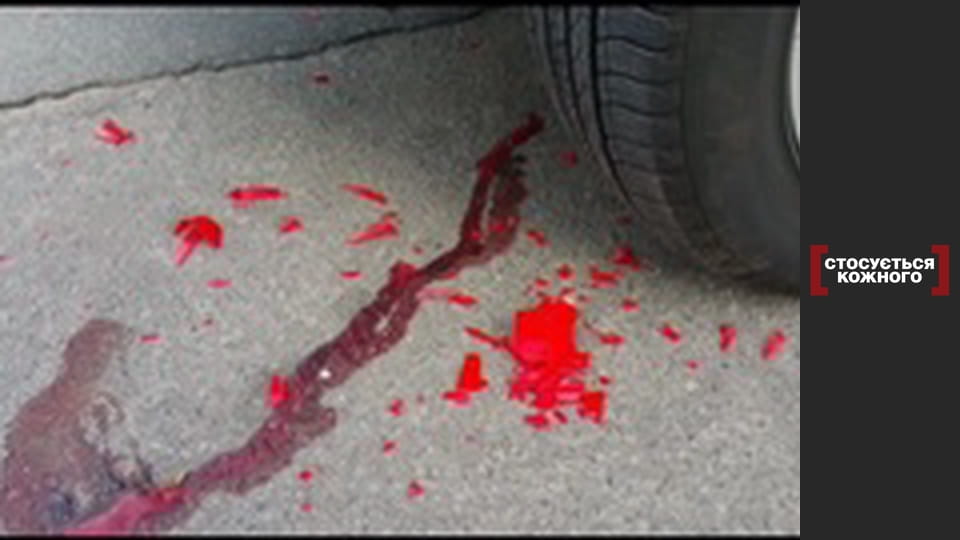 Privilege of impunity.