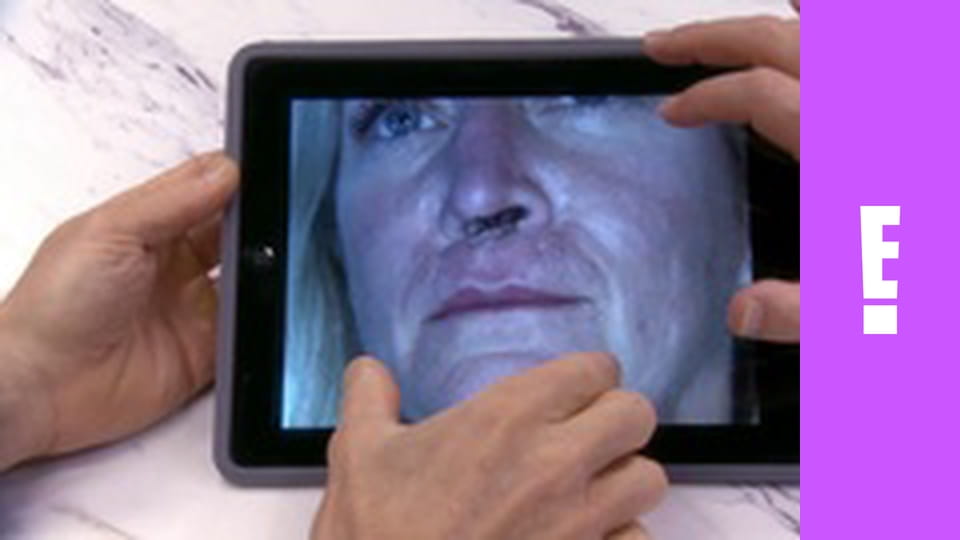 Botched S5E12 - Breast Lumps and Empty Noses