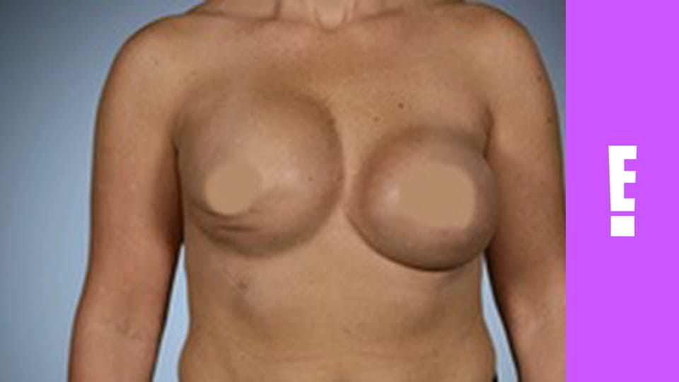 Botched S5E2 - Shake What Your Momma Didn't Give You