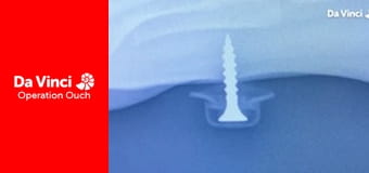 Operațiunea Au! - Gură contra genunchi