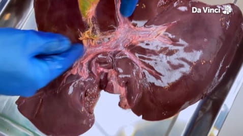 1. Fat-Busting Bile