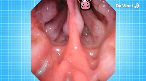 15. Porozmawiajmy o raku