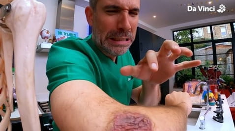 8. Itchy Crusty Scabs