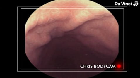 10. Widok z wnętrza jelit