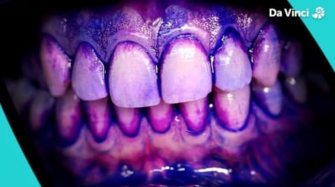 1. Sekretne życie zębów