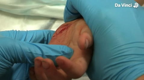 11. Oddawanie krwi ratującej życie