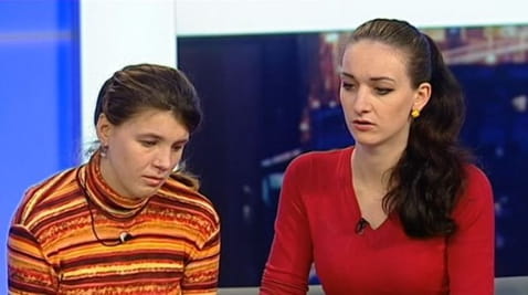 Раздвојени близанци