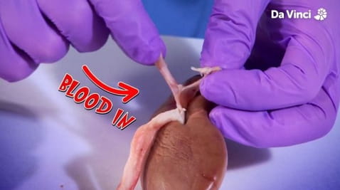 6. Maszyna do czyszczenia nerek