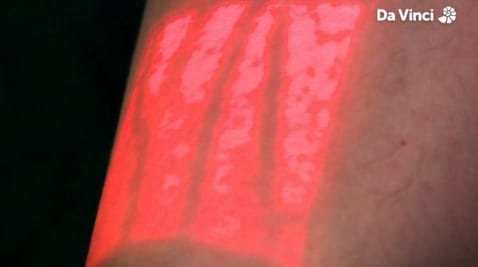 9. Zablokowane naczynia krwionośne