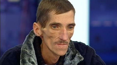 Болест страхова