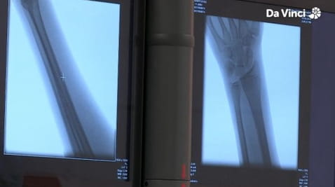 10. Mrugnij, a przegapisz to!