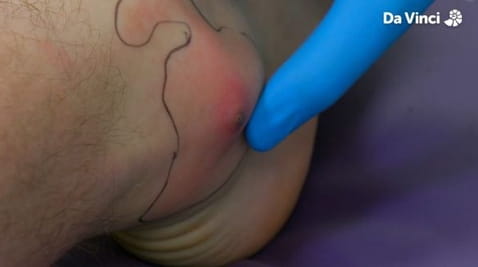 5. Ścięgno zdejmij!